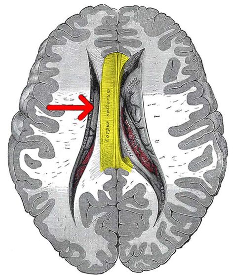 Crosstalk Between Left and Right Hemisphere Is Key to Language Development Corpus Callosum, Science Lover, Mental Disorders, Language Development, Human Anatomy, Neuroscience, Fig, Anatomy, Brain