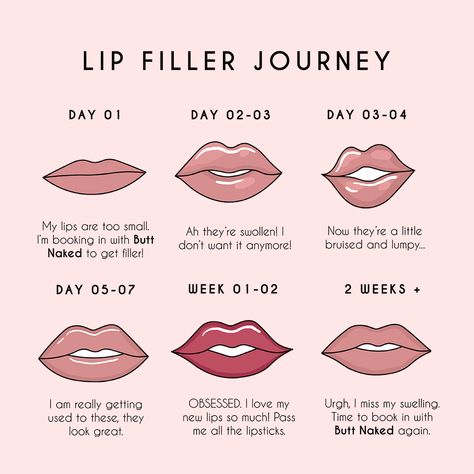 Lip Filler Memes Funny, Lip Filler Journey, Aesthetic Injections, Advanced Esthetics, Plastic Surgery Quotes, Botox Quotes, Aesthetic Nursing, Aesthetics Business, Cosmetic Injections