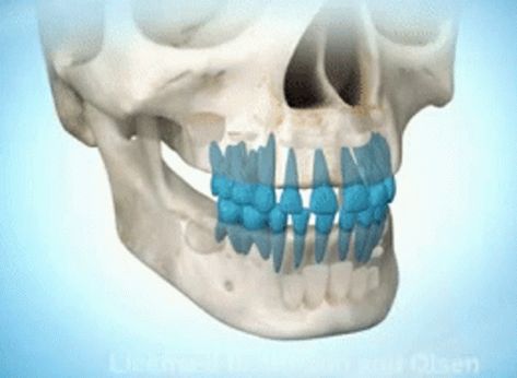 Teeth Eruption Growing GIF - Teeth Eruption Growing Teeth - Discover & Share GIFs Teeth Eruption, Dental Animation, Solar System Projects, Perfect Teeth, Grinding Teeth, Baby Teeth, Solar System, Animals And Pets, Animated Gif