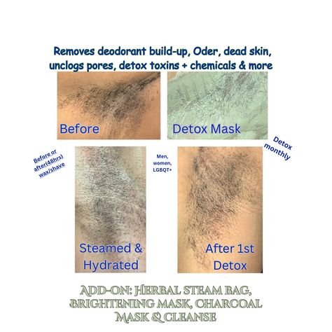 Underarm detox helps alleviate Oder, removes deodorant residue, dead skin & more. Imagine smooth, clean and soft underarms. Brighten them with natural turmeric for discoloration. Have to try it? Your Fav🧘🏾‍♀️Holistic Health Practitioner for Sacral Support in Cycle Syncing Coaching & Restorative Yoga Visit me at my Holistic Detox Spa📍Summerlin Las Vegas Yoni Steaming & Foot Detox. . . . . . . . . . . . . . #inspiredYonisteaming #Vsteaming #yashauninspires #selfcare #spa #lasvegas #summerlinl... Under Arm Detox, Herbal Steam, V Steam, Cycle Syncing, Steam Spa, Menstrual Cramps, Restorative Yoga, Holistic Health, Dead Skin