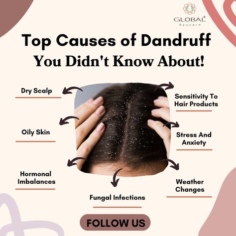 😲 Did you know dandruff has unexpected causes? It’s not just about dry scalp! Learn the surprising reasons and how to keep your hair flake-free! 💇‍♀️✨ 👉Click Here To Buy Herbal Products[https://tinyurl.com/yrmfnwz3] #DandruffTips #HealthyScalp #HairCareHacks #DandruffSolutions #HairHealth #WellnessTips #GlobalAyucareHerbal Hair Flakes, Dandruff Solutions, Ayurvedic Remedies, Herbal Products, Weather Change, Fungal Infection, Healthy Scalp, Dry Scalp, Hormone Imbalance