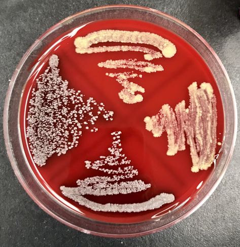 Clostridium Xylanolyticum (yellowish beige streaks) Clostridium Perfringens (White granulated streaks surrounded by darkening blood)  Sheep Blood Agar plate. #microbiology #medicallaboratoryscience #clinicallaboratoryscience. Agar Plates Microbiology, Lab Aesthetic, Clostridium Perfringens, Microbiology Study, Microbiology Lab, Clinical Chemistry, Medical Laboratory Science, Bio Art, Drone Technology