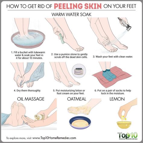 Here are some tips and remedies on how to get rid of peeling skin on feet with exfoliation and foot masks to relieve dryness. Top 10 Home Remedies, Diy Pedicure, Combination Skin Type, Pedicure At Home, Foot Scrub, Peeling Skin, Skin Care Steps, Oily Skin Care, Dry Skin Care