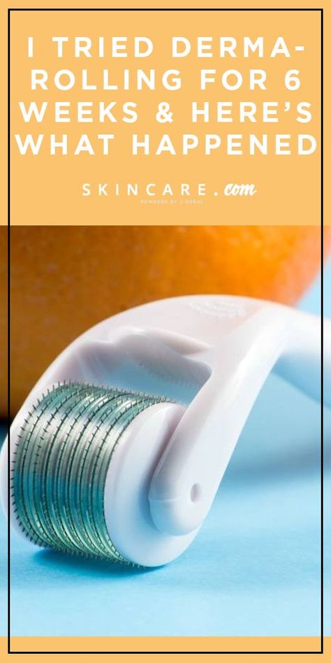 Micro Needling Benefits, Derma Roller Results, Skincare Gadgets, Rolling Face, Skin Wars, Microneedle Derma Roller, Derma Rolling, Calorie Snacks, Skin Needling