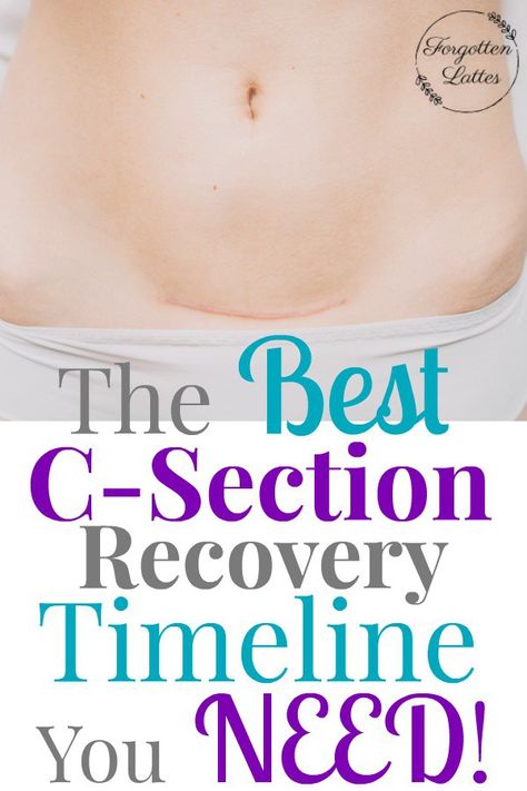 After experiencing two c-sections I decided it was finally time to write down a c-section recovery timeline. This helped me to stay encouraged and focused in my recovery after my second c-section. #csection #csectionrecovery #pregnancy #csectionrecoverytimeline #postpartum #postpartumrecovery #baby #motherhood #parenting After Csection Workouts, C Section Recovery Exercise Workouts, Exercise After C Section, Work Out After C Section, After Csection Exercise, Cesarian Section Recovery, Recovery After C Section, After Csection Recovery Tips, C Section Recovery Timeline