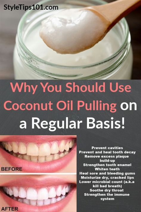 Teeth Enamel Repair, Tooth Enamel Repair, Oil Pulling Benefits, Mouth Health, Remedies For Tooth Ache, Heal Cavities, Whiten Teeth, Coconut Oil Pulling, Tooth Enamel