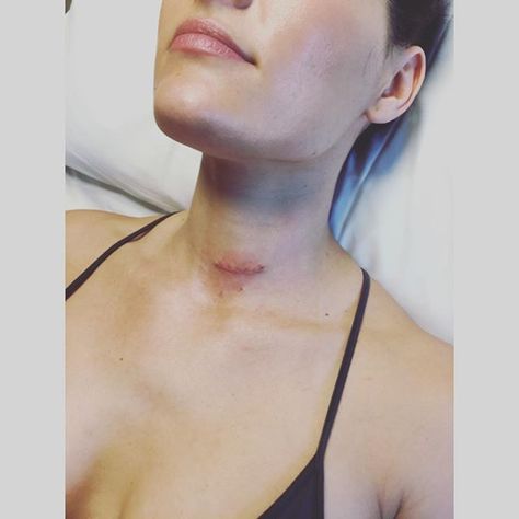 Warrior Wound  #stayfearless #druribe @tghcares Wwe Total Divas, Neck Surgery, Being Perfect, Brie Bella, Total Divas, Bella Twins, Nikki Bella, Wwe Womens, Professional Wrestler