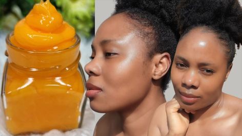 How i cleared sunburn,dark eye circle & achieve a smooth soft and ageless looking skin all year round | skin | How I cleared sunburn,dark eye circles & achieve a smooth soft and ageless looking skin all year round. | By Prudy Fairyin TV Juice For Dark Circles, Sun Burned Face, Skin Peeling From Sunburn, Healthy Skin Care Acne, Dark Sunken Under Eyes, Sunburnt Face, Get Rid Of Sunburn, Dark Eye Circles, Eye Circles