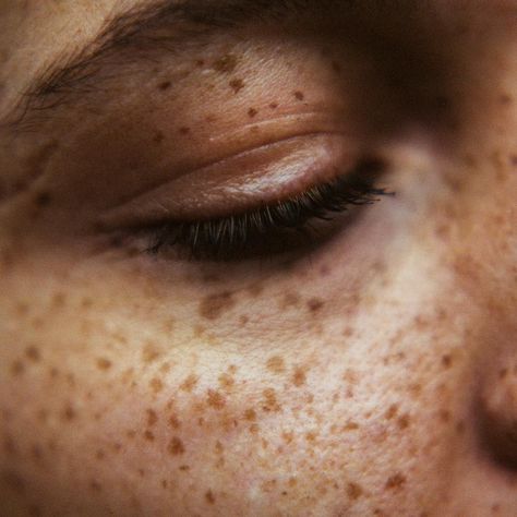 Freckled Back, Guy Freckles Aesthetic, Male Freckles Aesthetic, Freckled Aesthetic, Freckles Men Aesthetic, Tan Skin Freckles Aesthetic, Brown Eyes And Freckles Aesthetic, Tan Hands Aesthetic, Tan Freckled Skin