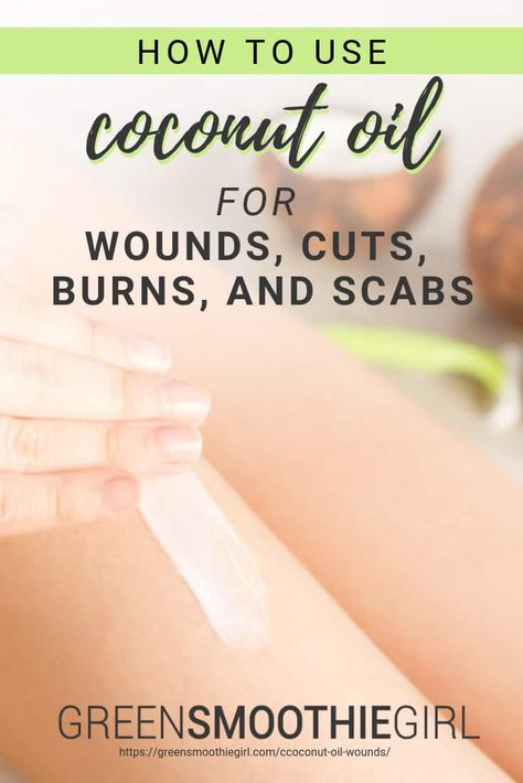 How to Use Coconut Oil for Wounds, Cuts, Burns, And Scabs | GreenSmoothieGirl Coconut Oil For Burns, Green Smoothie Girl, How To Heal Burns, Red Moles, Oils For Scars, Apply Coconut Oil, Refined Coconut Oil, Extra Virgin Coconut Oil, Coconut Oil Uses