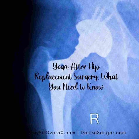 Yoga After Hip Replacement Surgery: What You Need to Know: https://howtostayfitover50.com/yoga-after-hip-replacement-surgery/ Hip Surgery Recovery, Glute Strengthening, Fitness For Women, Alternate Nostril Breathing, Hip Surgery, Gentle Yoga, Surgery Recovery, Hip Pain, Leg Muscles