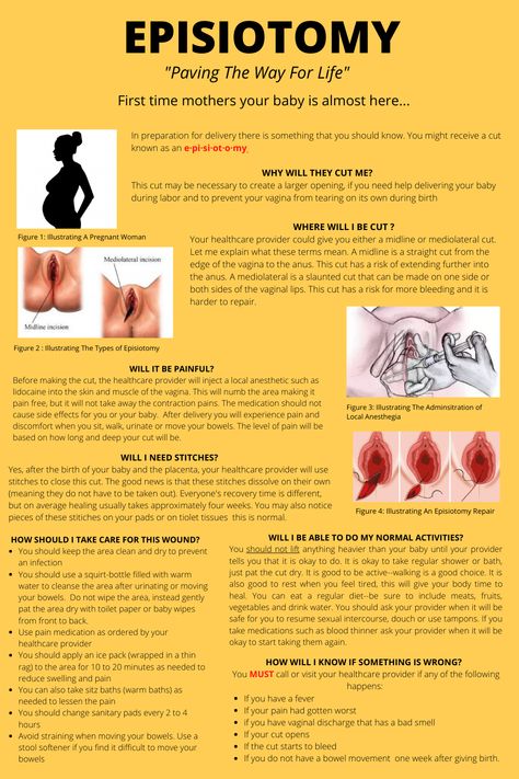 Midwifery Student Motivation, Midwifery Notes, Student Midwife Studygram, Obstretics And Gynecology, Midwife Vs Obgyn, Newborn Nursing, Learn Biology, Nurse Teaching, Midwifery Student