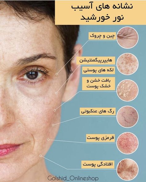 Facial Pictures, Instagram Story App, Beauty Skin Quotes, Skin Care Pictures, 2022 Instagram, Skin And Hair Clinic, Skin Facts, Skin Care Business, Skin Advice