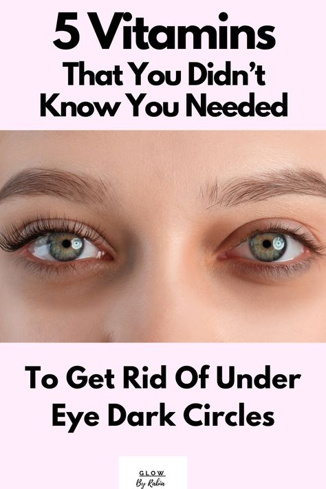 under eye dark circles What To Do With Dark Circles, Treat Dark Circles Under Eyes, Dark Around Eyes, Eye Bag Remedies, Puffy Eyes Remedy, Under Eye Dark Circles, Eye Dark Circles, Eyes Care, Dark Circles Around Eyes