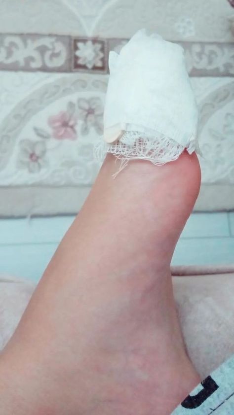 Bandage Snap, Girly Swag, Hospital Admit Hand Pics, Snap Streak Ideas Easy, Foot Injury, Cute Images For Dp, New Photo Download, Best Poses For Pictures, Classy Photography