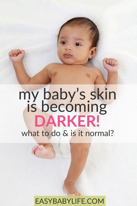 Some parents are truly worried about how their baby's skin color is developing. Learn what's normal regarding your baby's complexion. Baby care, skin color, baby tips, parenting, baby skin color change #baby Normal Quotes, Baby Fair, Breastfeeding Baby, Baby Life Hacks, Dark Complexion, Skin Colour, Baby Care Tips, Skin To Skin, Parenting Toddlers