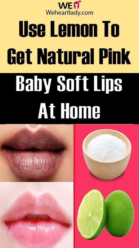 Tips For Pink Lips, Remedies For Dark Lips, Natural Pink Lips, Bright Pink Lips, Lips Care, Lip Care Tips, Lip Tips, Ootd Instagram, Lip Care Routine