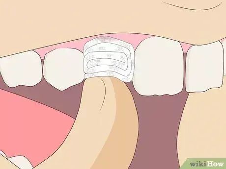 How to help loosen and remove your child's tooth at homeIf your child begs you to help them pull out a loose tooth, you may not know what to do. Loose teeth are a part of childhood, and your child will typically start losing their teeth... Loose Teeth, Tooth Pulled, Loose Tooth, Oil Pulling, Better Sleep, Le Point, Aurora Sleeping Beauty