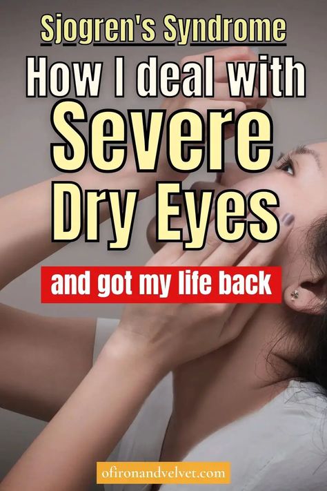 I Have Sjogren’s Syndrome And This Is How I Deal With Severe Dry Eyes - Of Iron and Velvet Dry Eye Remedies, Eye Health Remedies, Remedies For Dry Mouth, Chronic Dry Eye, Dry Eyes Causes, Warts Remedy, Dry Eye Symptoms, Natural Remedies For Migraines, Eye Pain