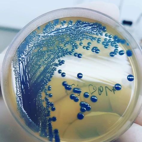 Medical Laboratory Science Student, Klebsiella Pneumoniae, Microbiology Lab, Antimicrobial Resistance, Labs Art, Medical Laboratory Science, Vet School, Lab Rats, Laboratory Science