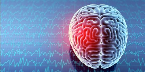 How Does SPECT Differ from Other Brain Scans? | Amen Clinics Symptoms Of Concussion, Sistem Saraf, Brain Injuries, Brain Diseases, Brain Stimulation, Brain Scan, Brain Damage, Whiplash, Brain Activities