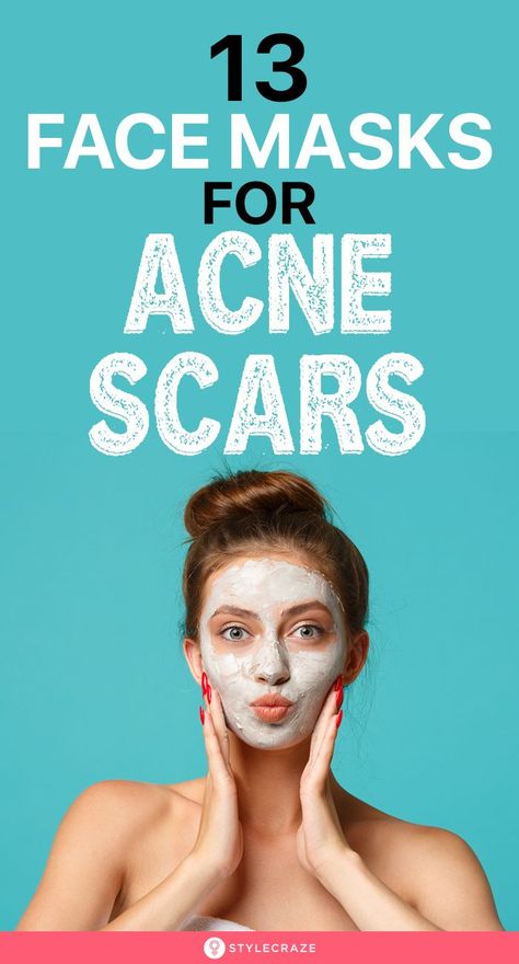 13 Best Face Masks For Acne Scars: Now, who’s ready to mask those stubborn marks with the best? Check out our list of the 13 best face masks for acne scars. #acnescars #facemask #skincare #skincaretips #beauty #beautyhacks Face Mask For Acne Marks, Face Masks For Acne, Masks For Acne, Acne Beauty, Facemask Skincare, Acne Scar Mask, Turmeric Face, Turmeric Face Mask, Best Face Masks