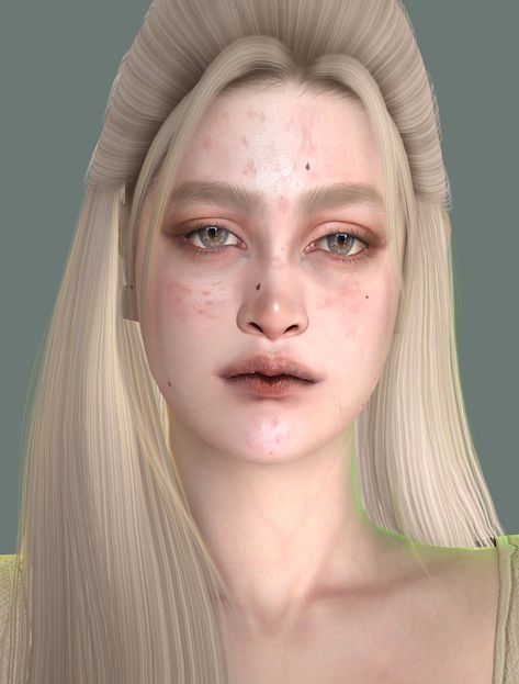 Acne Mod Sims 4, Pimples Sims 4 Cc, Ts4 Acne Cc, The Sims 4 Acne Cc, Sims 4 Skin Details Acne, Sims Cc Acne, Sims 4 Cc Skin Acne, Sims 4 Cc Acne Patreon, Ts4 Acne