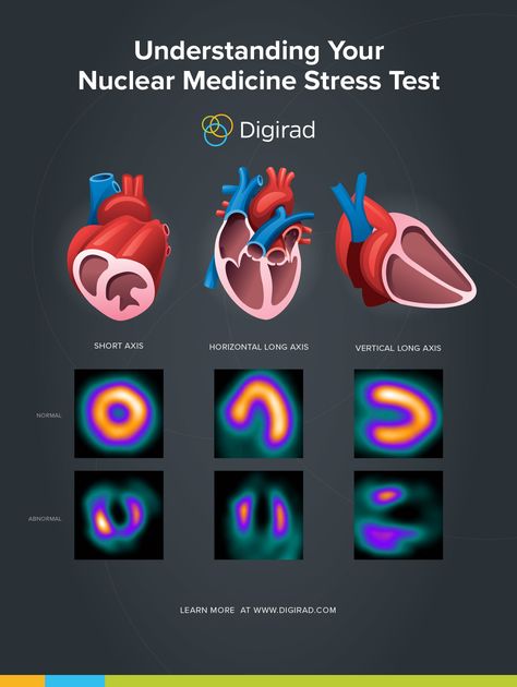 Understanding Your Nuclear Medicine Stress Test | Digirad Human Hearts, Coronary Artery, Test Image, Angina Pectoris, Nuclear Medicine, Cramps Relief, Heart Muscle, Health Hacks, Very Tired