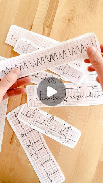 Kristine Tuttle on Instagram: "Get a pulse on your EKG rhythm strip knowledge 🫀😉  Does your program offer a dedicated certification course or week for EKG interpretation?!  #nursingnotes #RN #BSN #nursing #nurseinthemaking #EKG #cardiacnurse" Ekg Rhythms Cheat Sheets, Basic Ekg Rhythms, Ekg Interpretation Made Easy, Acls Study Guide, Lethal Rhythms Ekg, V Fib Cardiac Rhythms, Ekg Rhythms, Bsn Nursing, Nursing Ideas