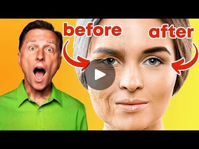 Stop Aging, Dr Eric Berg, Eric Berg, Dr Berg, Biochemistry, Aging Process, Live Long, Look Younger, Health Remedies