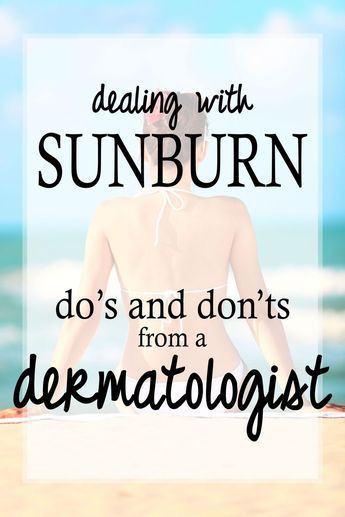 Check out these great tips on how to treat a sunburn, from a dermatologist! Sunburn On Face, Treating Sunburn, Sunburn Face, How To Help Sunburn, Sunburnt Face, Natural Aging Skin Care, How To Treat Sunburn, Antiaging Skincare, Best Face Wash