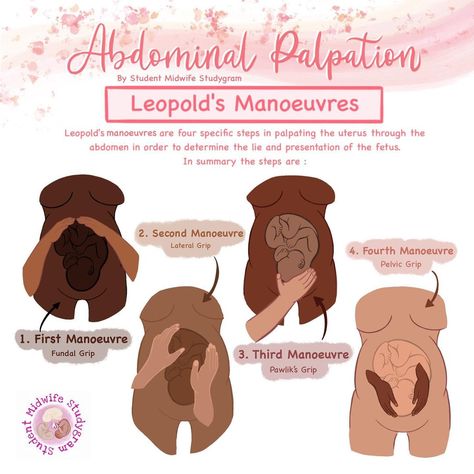 Student Midwife Studygram on Instagram: “🙏🏼 Abdominal Palpation ~ Leopold’s Manoeuvres ~ Christian Gerhard Leopold (1846-1911)] 🙏🏼 Leopold manoeuvres are a way to determine how…” Nurse Midwife Student, Student Midwife Studygram, Leopolds Maneuver, Nursing School Studying Cheat Sheets, Nurse Teaching, Midwifery Student, Student Midwife, Nursing School Essential, Nursing School Motivation