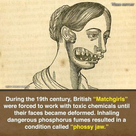 Scary Facts Horrifying True, Phossy Jaw, Scary Horror Stories, Scary Quotes, Short Creepy Stories, Scary Facts, Creepy Facts, Spooky Stories, English Factory