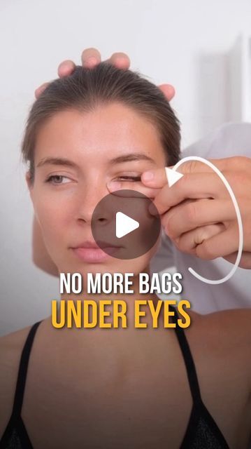 Eye Bags Remedy How To Get Rid, Bag Eyes How To Get Rid, Get Rid Of Bags Under Eyes, How To Get Rid Of Bags Under Eyes Fast, How To Fix Under Eye Bags, Get Rid Of Under Eye Bags, How To Get Rid Of Bags Under Eyes, Eyebags Remedy Under Eyes, How To Get Rid Of Eye Bags Fast