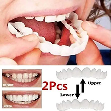 Perfect Smile Teeth, Teeth Veneers, Snap On Smile, Teeth Covers, Misaligned Teeth, Veneers Teeth, Bad Teeth, Teeth Whitening Diy, False Teeth