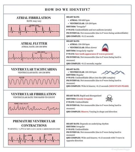 Stephanee Beggs, RN, BSN on Instagram: "EKG Rhythms Cheat Sheet!!🫀Learn to identify and treat these rhythms. This is PACKED with info…I tried to make it as simple as I can for y’all 🥰 Save and share with a friend!!" Ekg Notes, Med Surge, Ekg Rhythms, Cardiac Rehab, Doctor Stuff, Nurse Practioner, Medical Terminology Study, Physical Therapy School, Medical Assistant Student