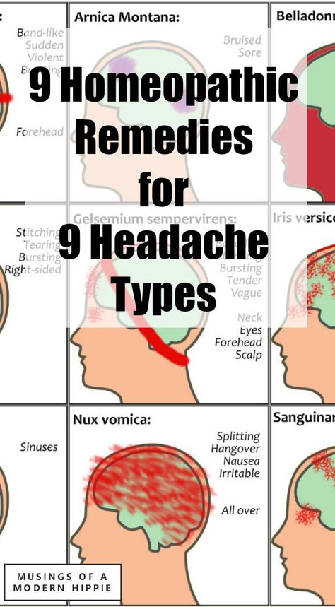 Homeopathy for Headaches | Musings of a Modern Hippie Homeopathy For Migraines, Homeopathy For Headaches, Homeopathy Headache Chart, Headache Homeopathy, Intercranial Hypertension, Natural Headache, Homeopathy Remedies, For Headaches, Headache Types