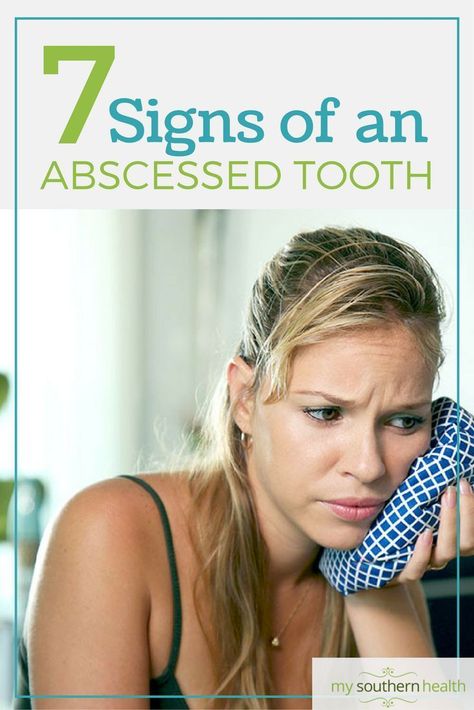 More than just a toothache -- know the 7 symptoms of an abscessed tooth. #mysouthernhealth #oralcare #absessedtooth #toothachetips Absessed Tooth, Abcessed Tooth, Abscess Tooth, Tooth Pain Remedies, Wisdom Teeth Pain, Tooth Pain Relief, Tooth Extraction Aftercare, Wisdom Teeth Funny, Impacted Tooth