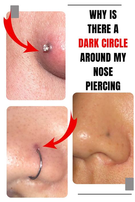 Why Is There A Dark Circle Around My Nose Piercing How To Care For Nose Piercing, Nose Piercing Tips, Nose Piercing Scar, Nose Piercing Care, Nose Piercing Healing, Piercing Care, Nose Piercings, Dark Circle, Black Ring