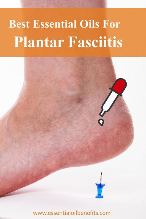 Facitis Plantar, Foot Pain Relief Remedies, Pain Relief Remedies, Essential Oils For Pain, Essential Oil Remedy, Essential Oils Guide, Oil Remedies, Essential Oils Herbs, Foot Pain Relief