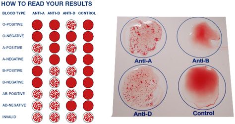 Blood Typing Blood Type Chart, Blood Type Personality, Different Blood Types, Medical Lab Technician, Blood Types, Science Models, Medical School Life, Biology Labs, Medical Laboratory Science