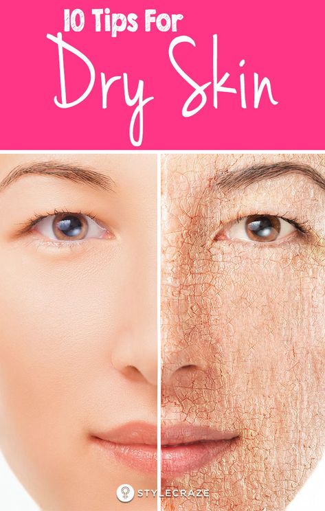 10 Top Tips For Dry Skin: No individual would prefer to keep themselves in a state where the skin is dry and feeling stretchy. So what do you think you can do?Fret not! Here are a few great and natural dry skin care tips that will help you relieve your parched to thus offer you soft, shiny and hydrated skin. #Skin #SkinCare #SkinCareTips Tips For Dry Skin, Dry Skin Diy, Peeling Facial, Dry Skin Care Routine, Extremely Dry Skin, Dry Skin On Face, Skin Images, Dry Skin Remedies, Natural Glowing Skin