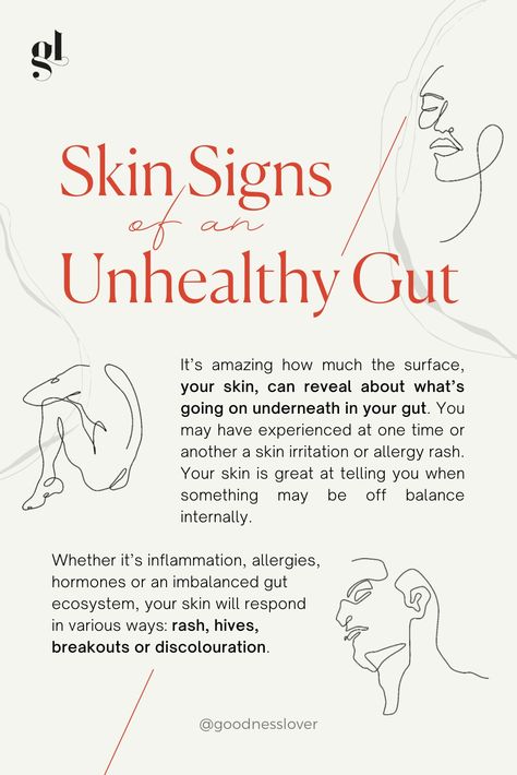 Some say that better skin has everything to do with the skincare products, cosmetics and cosmetic procedures. 💄💋

Others say that treating your skin starts with looking at what’s happening within your body, especially your gut. 🤰

But what does the science tell us? Here’s what you need to know about the connection between your gut and your skin. 🧏‍♀️

Read the full blog and learn about the skin signs of an unhealthy gut and what you can do about it. ✨ Minerals Your Body Needs, Gut Skin Connection, Gut Health And Skin, Improve Gut Health, Gut Healing, Cosmetic Procedures, Health Check, Healthy Gut, Health Articles