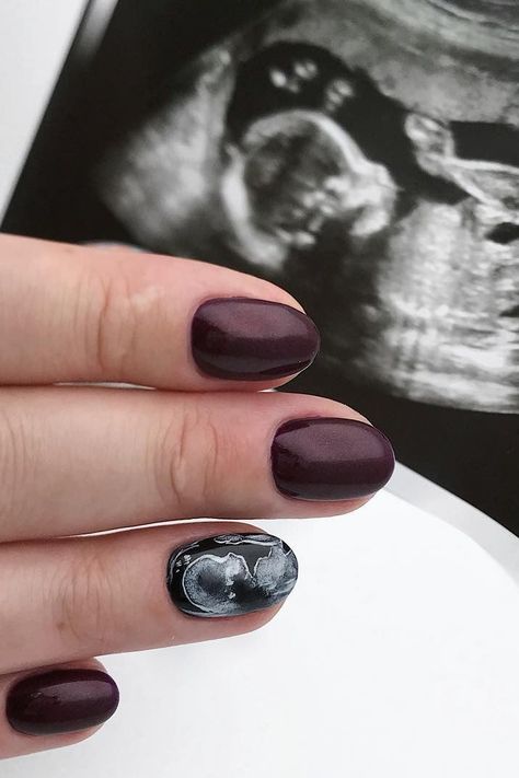 This Mesmerizing Ultrasound Nail Trend Lets You Subtly Reveal Your Pregnancy Purple Nail Beds, New Nail Trends, Short Coffin Nails, Baby Nails, Crazy Nails, Halloween Nail Art, Beautiful Nail Art, Nail Paint, Valentine's Day Nails