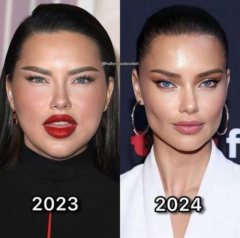 Adriana Lima Now, Plastic Surgery Gone Wrong, Celebrity Plastic Surgery, The Kardashians, Hottie Women, Adriana Lima, Most Expensive, Famous Celebrities, Plastic Surgery