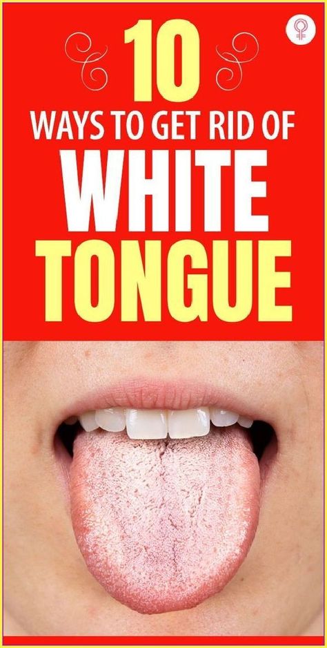 What Your Tongue Says About Your Health White Tongue, Health Signs, Tongue Health, Oral Care Routine, Oral Health Care, Nail Health, Tooth Decay, Oral Hygiene, Oral Health