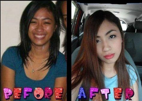 Glutathione Before And After, Dry Skin Makeup, Dry Skin Problem, Before And After Pics, Diy Anti Aging, Scaly Skin, Anti Aging Supplements, Anti Aging Tips, Skin Care Recipes