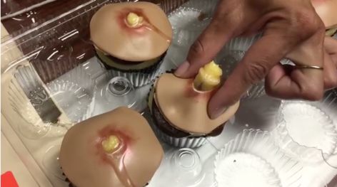 15 gross-out cakes we’re sure taste perfectly good, but… ew – SheKnows Pimple Cupcakes, Gross Cakes, Litter Box Cake, Gross Halloween Foods, Brain Cake, Birth Cakes, Charm City Cakes, Zombie Cake, Lamb Cake