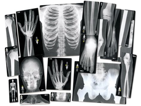 Science Skeleton, Human Skeletal System, Parts Work, Overhead Projector, Xray Technician, Lakeshore Learning, Eye Chart, Skeletal System, X Rays