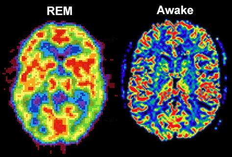 rem brain vs awake brain Neuro Science, Brain Sleep, Brain Scans, Deep Sleep Meditation, Brain Activity, Brain Scan, Rem Sleep, Rhythmic Pattern, Brain Cells